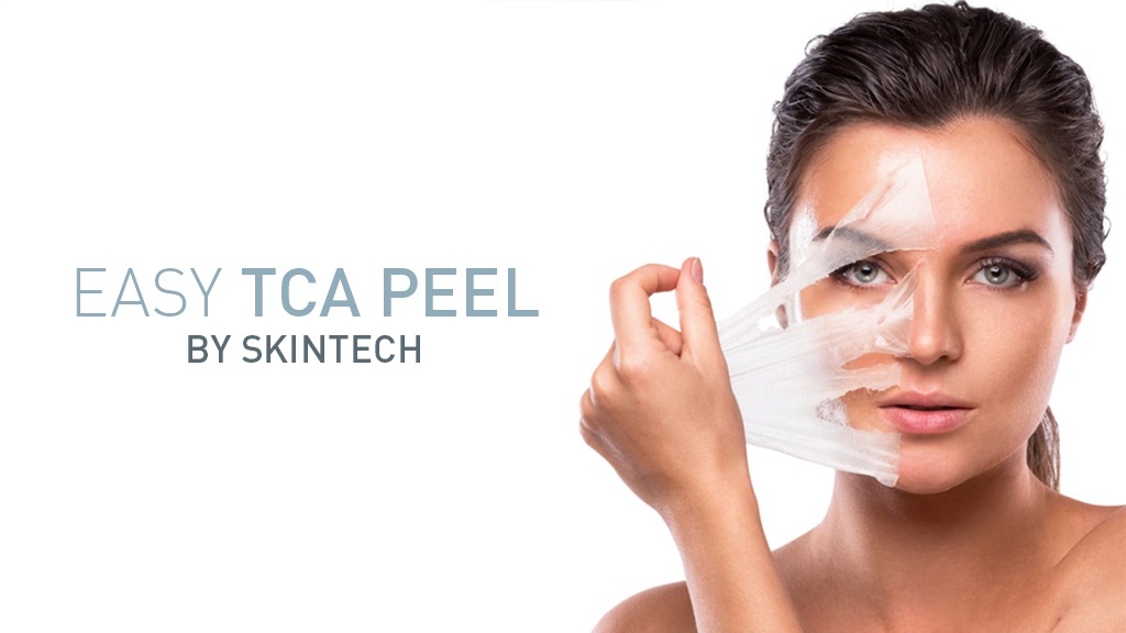 TCA Multi Acid Face Peel